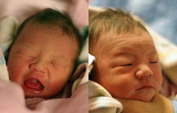 ��X�ͪ��p��